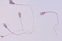 Spermatozoïdes de Taureau x250 